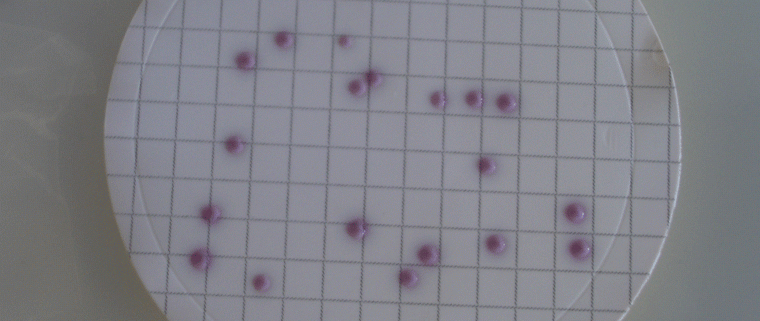 Petrischale Enterobacter-cloacae-Kultur